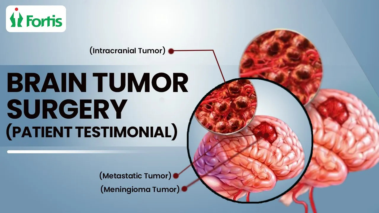 Brain Tumor Surgery