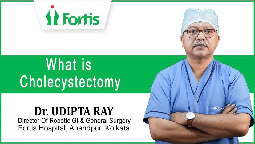 What is Cholecystectomy?