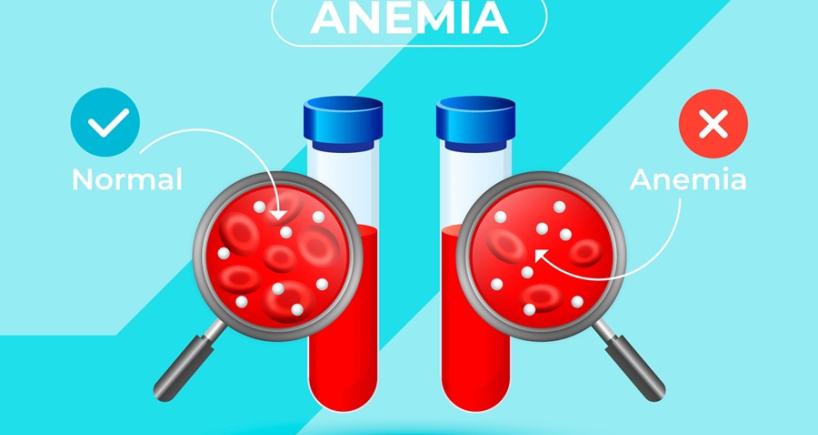 Understanding Anemia