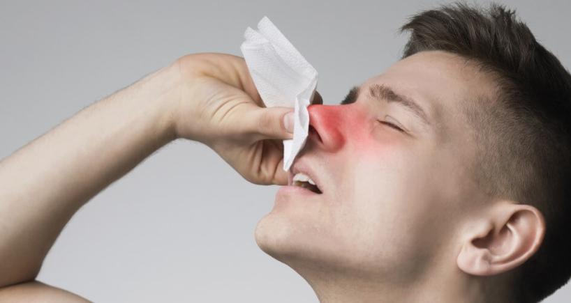 Understanding Epistaxis