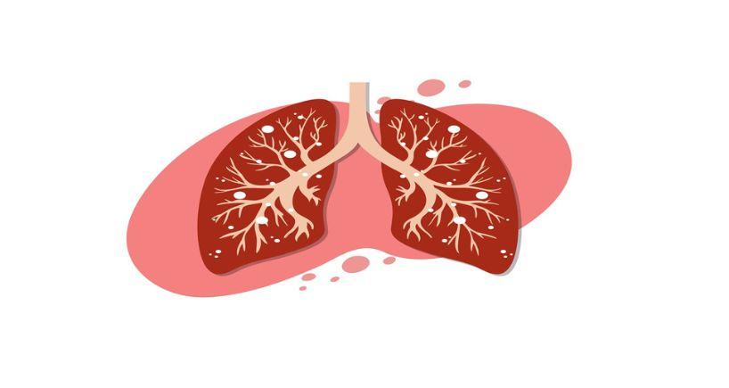 Understanding Bronchitis