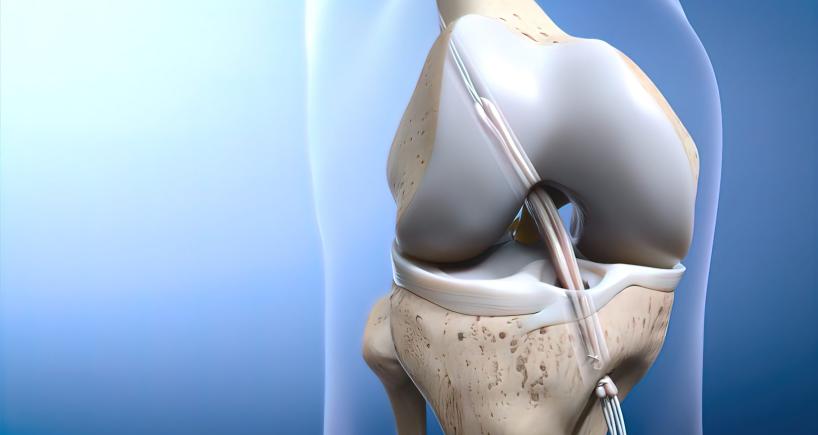 Understanding ACL Repair