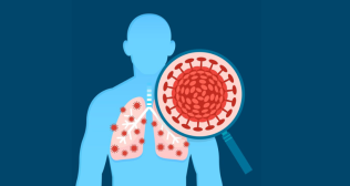  Common Respiratory Diseases