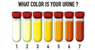 urine colour effects