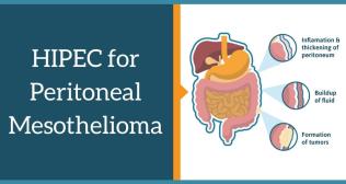 Peritoneal Malignancies and HIPEC Surgery