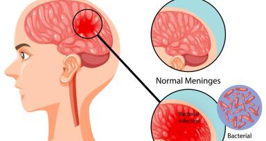 Meningitis Symptoms in Adults