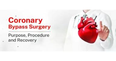 Coronary Bypass Surgery