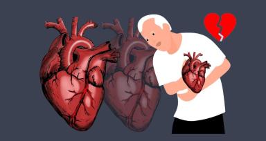 Coronary Artery Spasms 